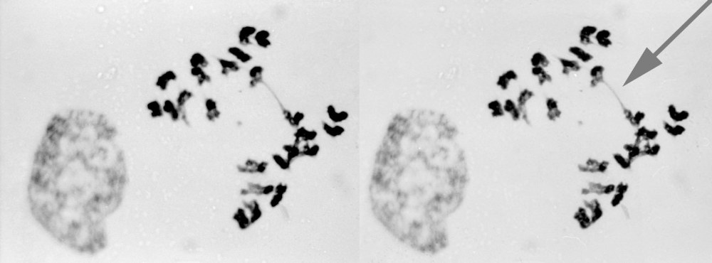 A Chromosome Bridge (arrow) at anaphase of mitosis in Tradescantia virginiana